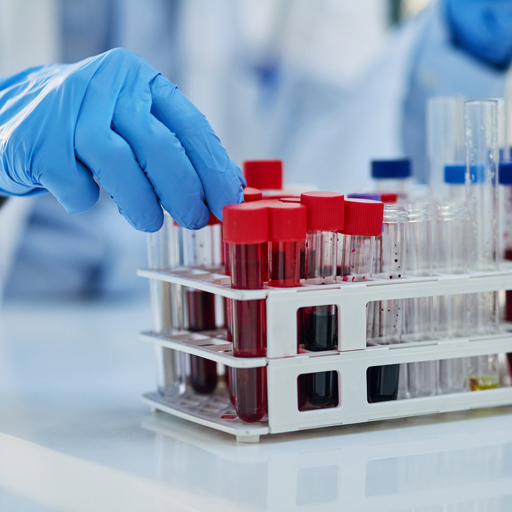 Regenerative Medicine for Pain Relief by Whole Family Chiropractic in Anchorage AK