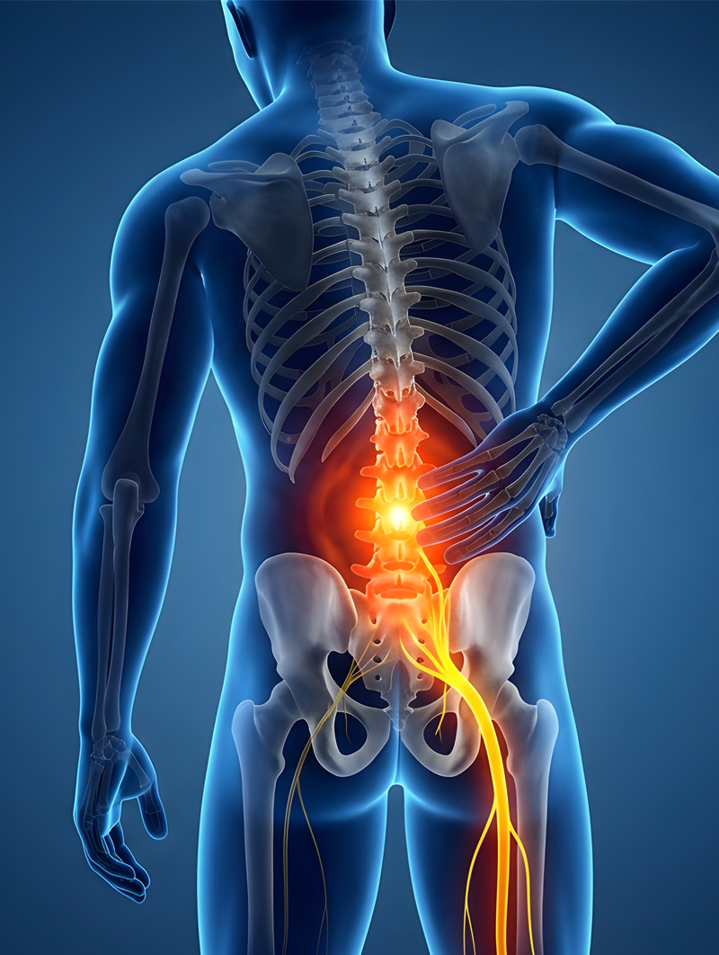 best-sciatica-relief-anchorage