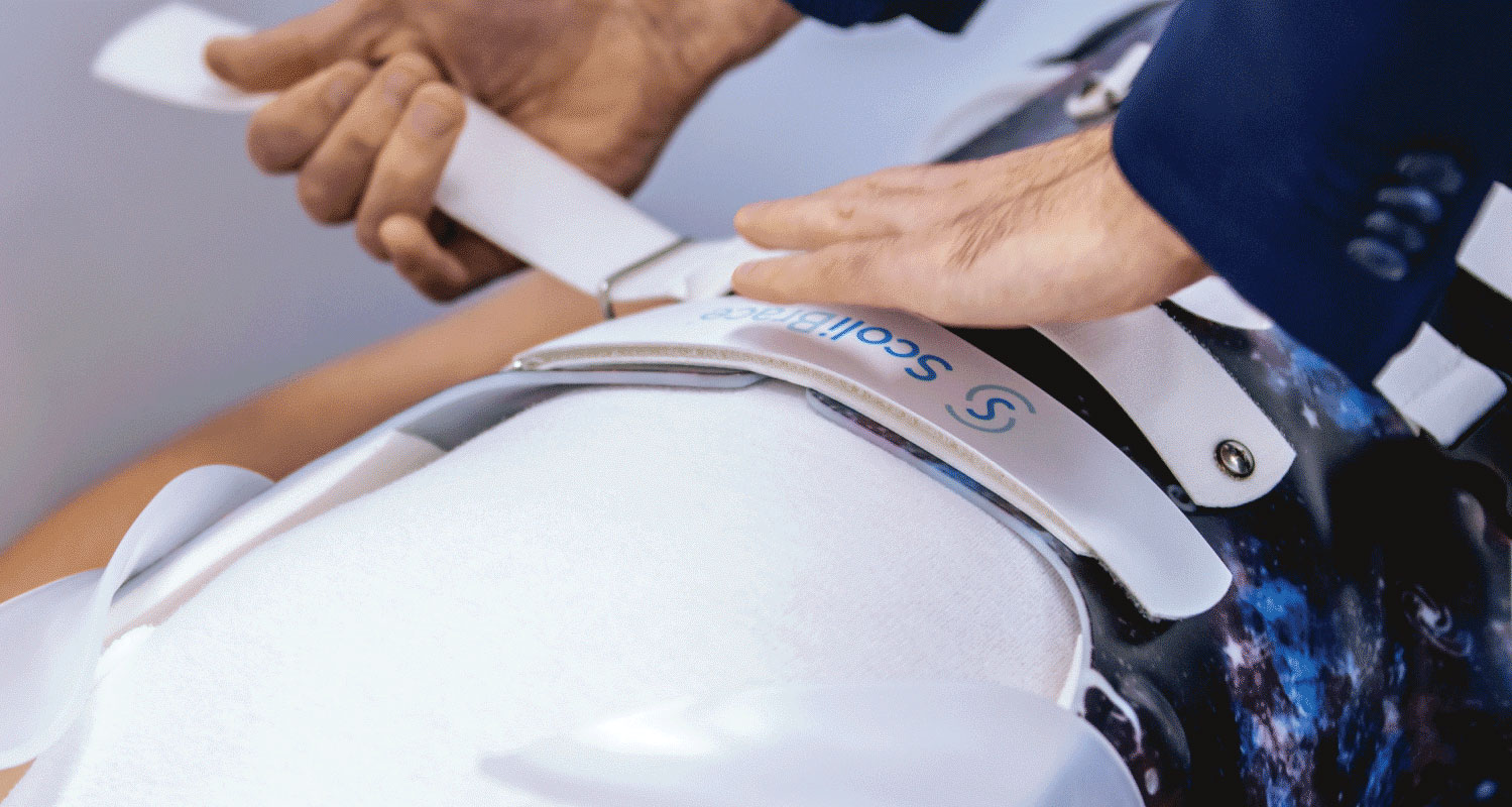 Specialist fitting a custom ScoliBrace to provide three-dimensional scoliosis correction and non-surgical spinal treatment in Anchorage.
