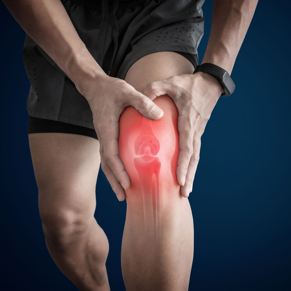 Knee Pain, Arthritis, and Overuse Injuries